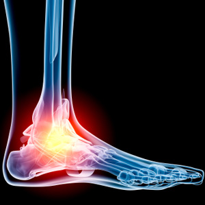 Ankle and foot diseases